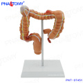 PNT-07451 Human intestinal model Diseased Large Intestines model for education